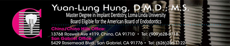 Chino Dental Implant