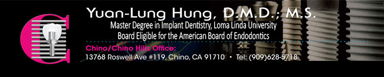 Chino Dental Implant